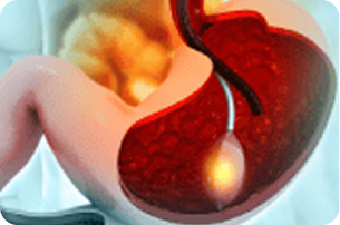 Infarto Agudo do Miocárdio: sinais de alerta e prevenção