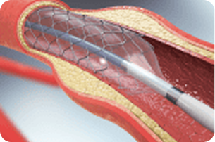 Arritmias: o que são e como afetam o coração